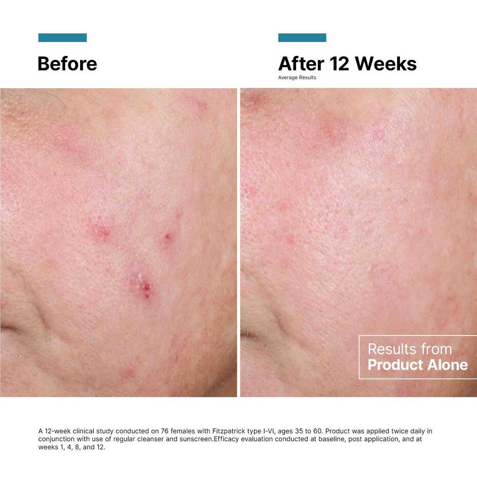 Advanced RGN-6 50ml - Image 4